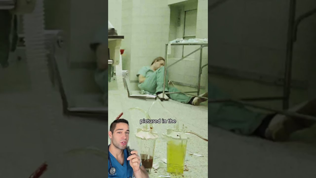 Surgeon Is On The Top Photo Of 1987 Here Why