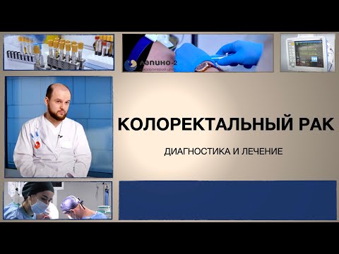 Колоректальный рак: симптомы, диагностика и лечение.