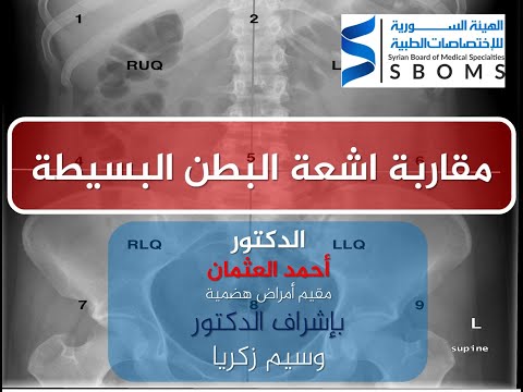 فيديو: الجيوب الانكماشية - الأعراض والعلاج والأسباب الأكثر شيوعًا