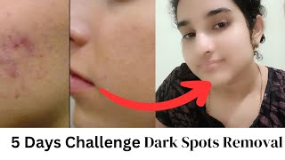 *5 Days challenge*Dark spots on Face Removal Face Wash diy