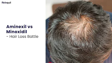 Aminexil vs Minoxidil - Hairloss Battle