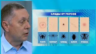 Что делать при укусах насекомых? Эфир ТК Доктор