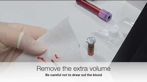 AutoDX   HbA1c Test Procedure   EDTA, Capillary (4F03)