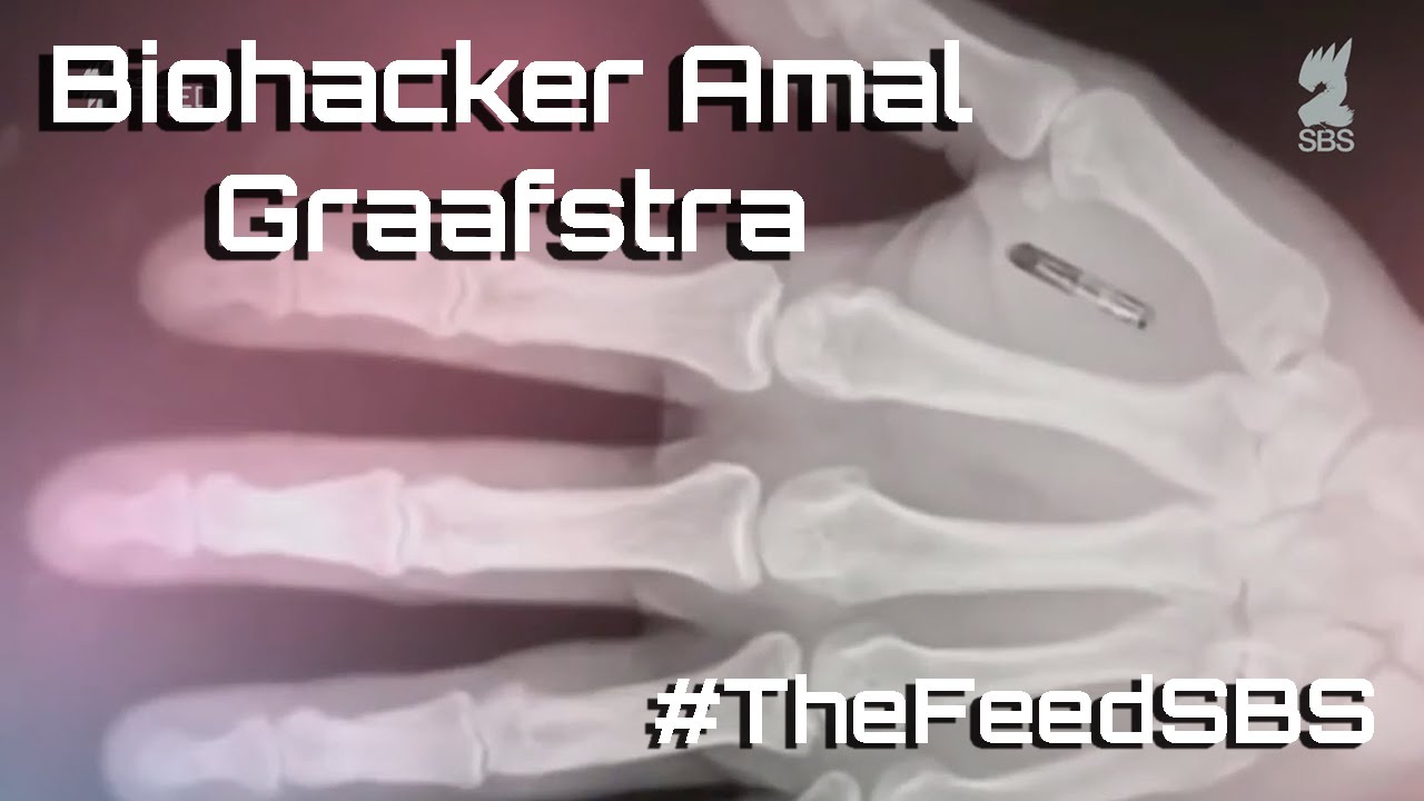 the feed contains test content Biohacker Amal Graafstra - The Feed