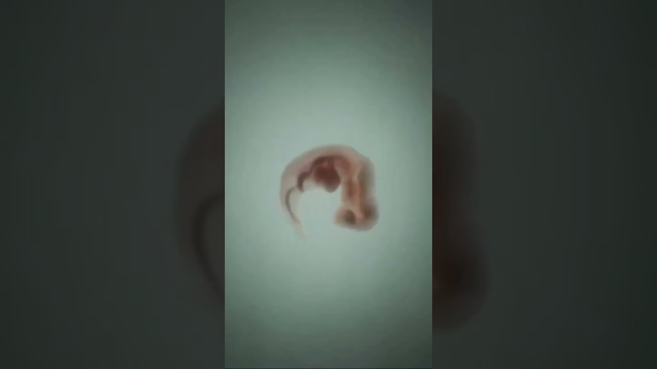 ОПЛОДОТВОРЕНИЕ ПОД МИКРОСКОПОМ