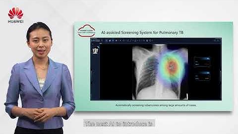 All-in-One Medical Imaging AI Solution - HUAWEI CLOUD x HY Medical