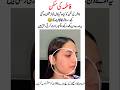 Fatima ki skin ko kia ho gia 🤔#trendingvideo#shortfeed#fatima#iqrakanwal#sistrology#viral