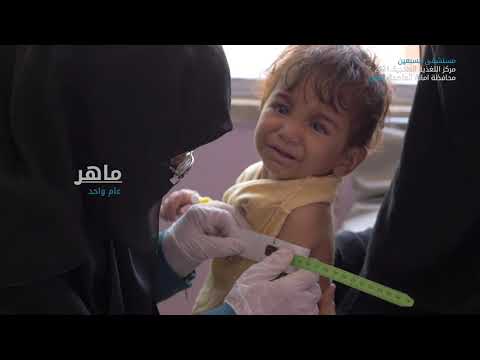 مركز التغذية العلاجية في أمانة العاصمة