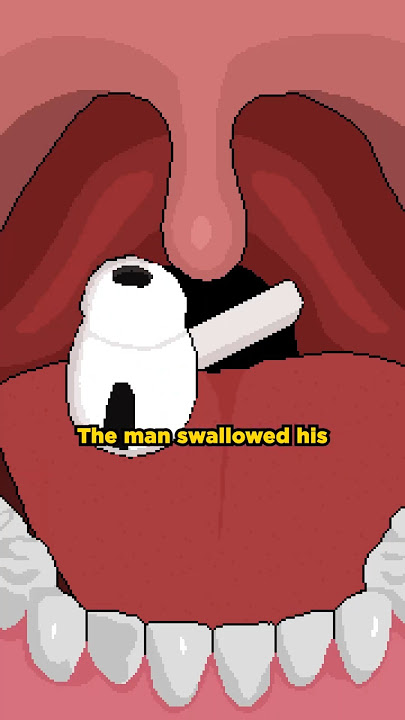 Man Swallows AirPod - Still Works! 😮