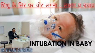 Gasping Condition In Baby | Paediatric Intubation | Intubation Procedure In Newborn | Intubation