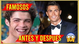 🌟 ANTES Y DESPUÉS 🌟 DE LOS *FAMOSOS* #2