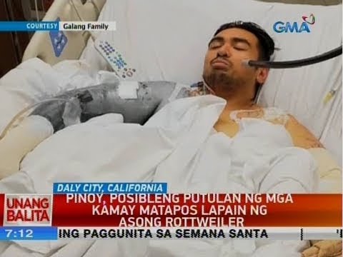 UB: Pinoy, Posibleng Putulan Ng Mga Kamay Matapos Lapain Ng Asong Rottweiler