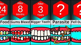 Comparison: If You Never Brushed Your Teeth Again