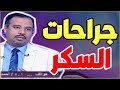 جراحات السكر ما هي وكيف نشأت ومدى فاعليتها دكتور أحمد السبكي يجيب