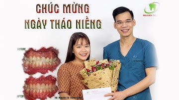 Niềng răng chữa khớp cắn ngược trong bao lâu?