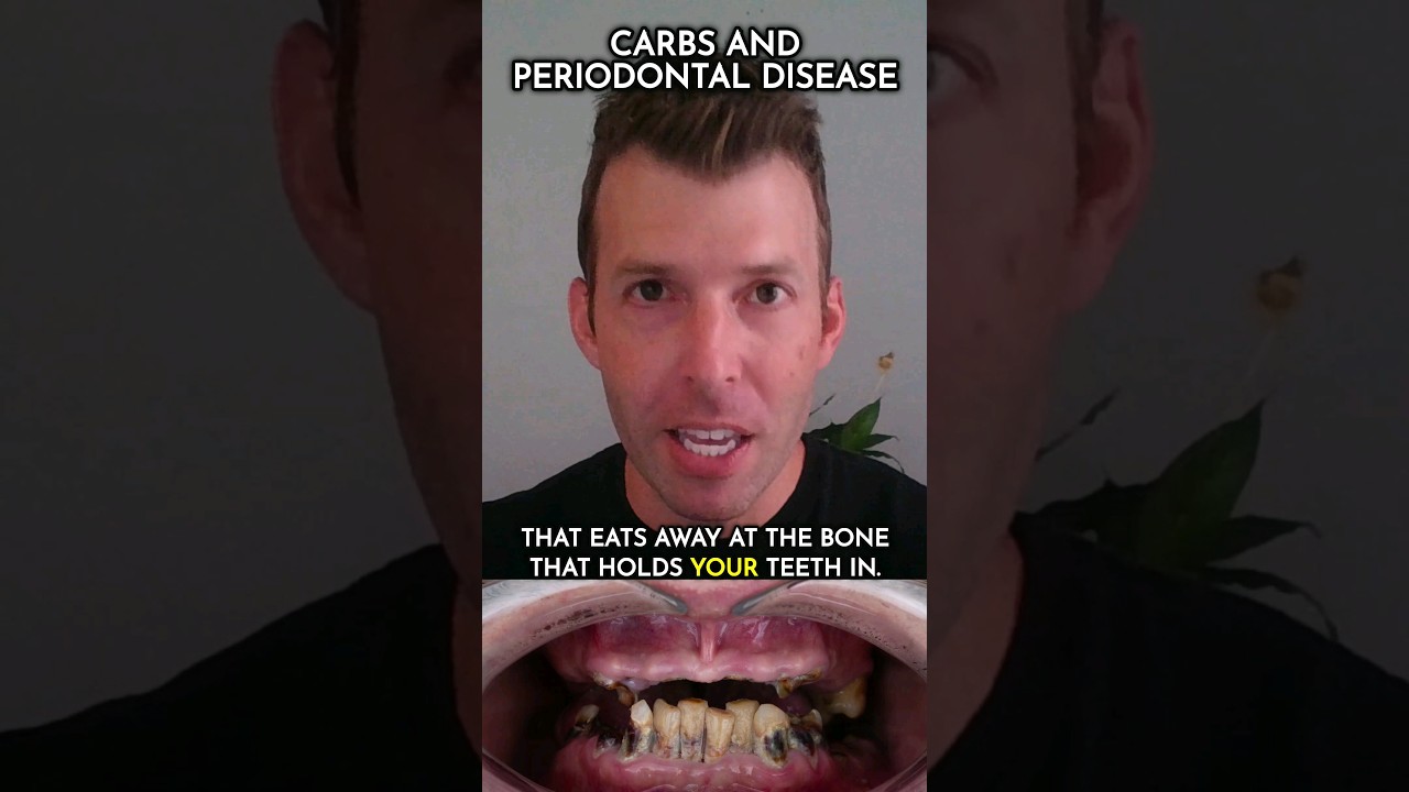 Watch Eats away the bone that holds in your teeth on YouTube Watch Eats away the bone that holds in your teeth on YouTube