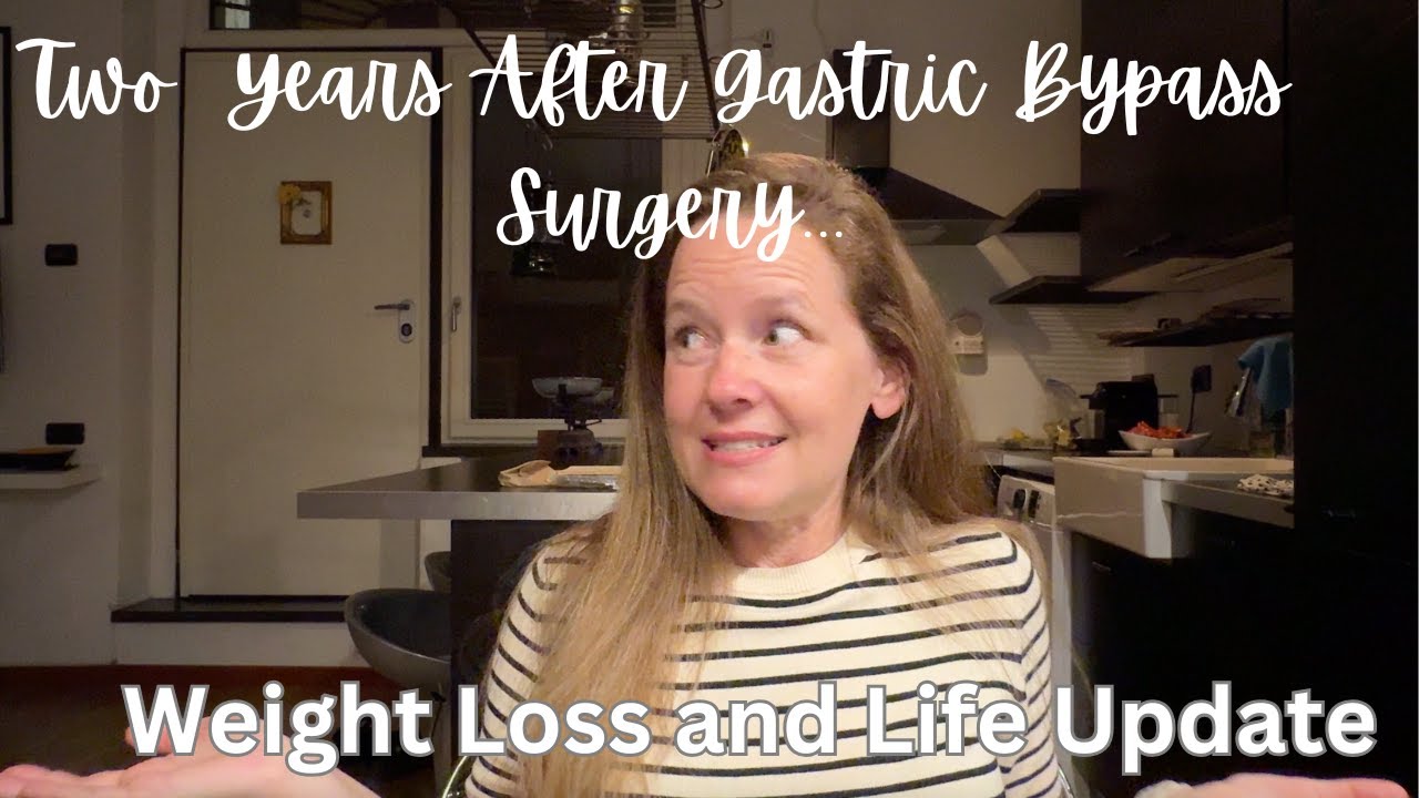 Life Update: Two Years After My Gastric Bypass/RNY Weight Loss Surgery - How I'm Doing