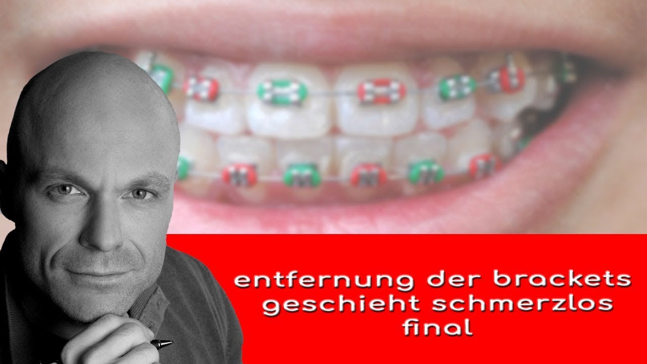 entfernung der brackets geschieht schmerzlos YouTube