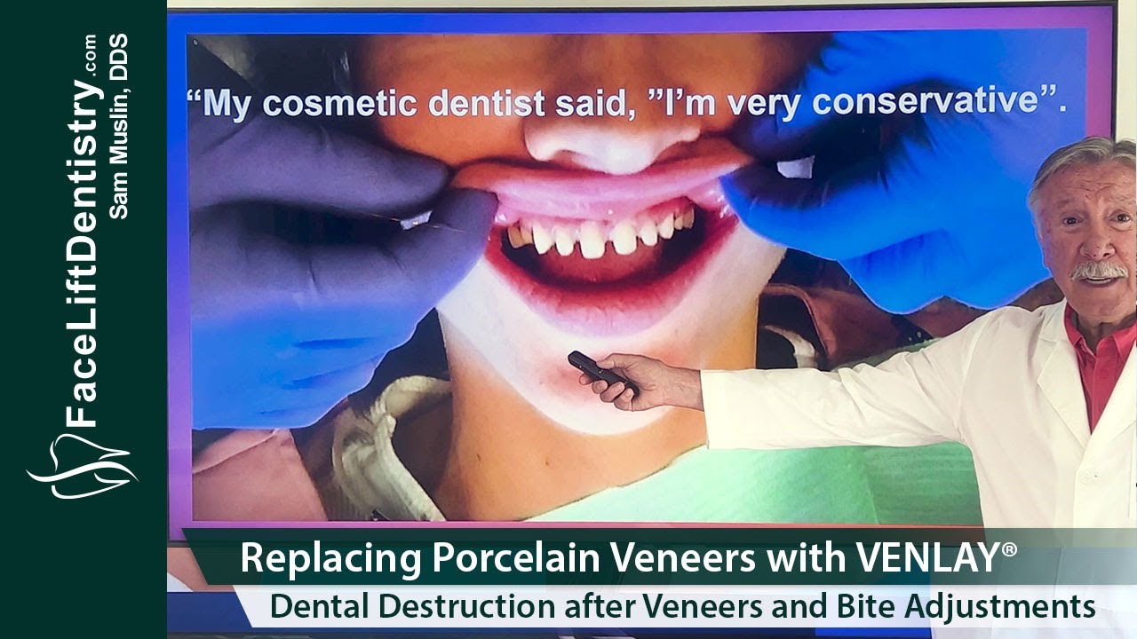 Replacing Porcelain Veneers with VENLAY® Restorations YouTube