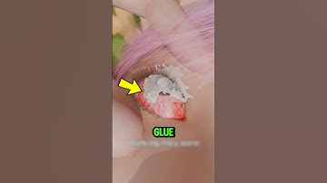 If You Ever Get Super Glue in Your Eye, Do This Immediately