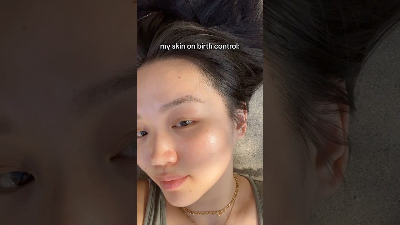 I get asked why I don’t have clear skin as an influencer and here is the reason why 🥲 