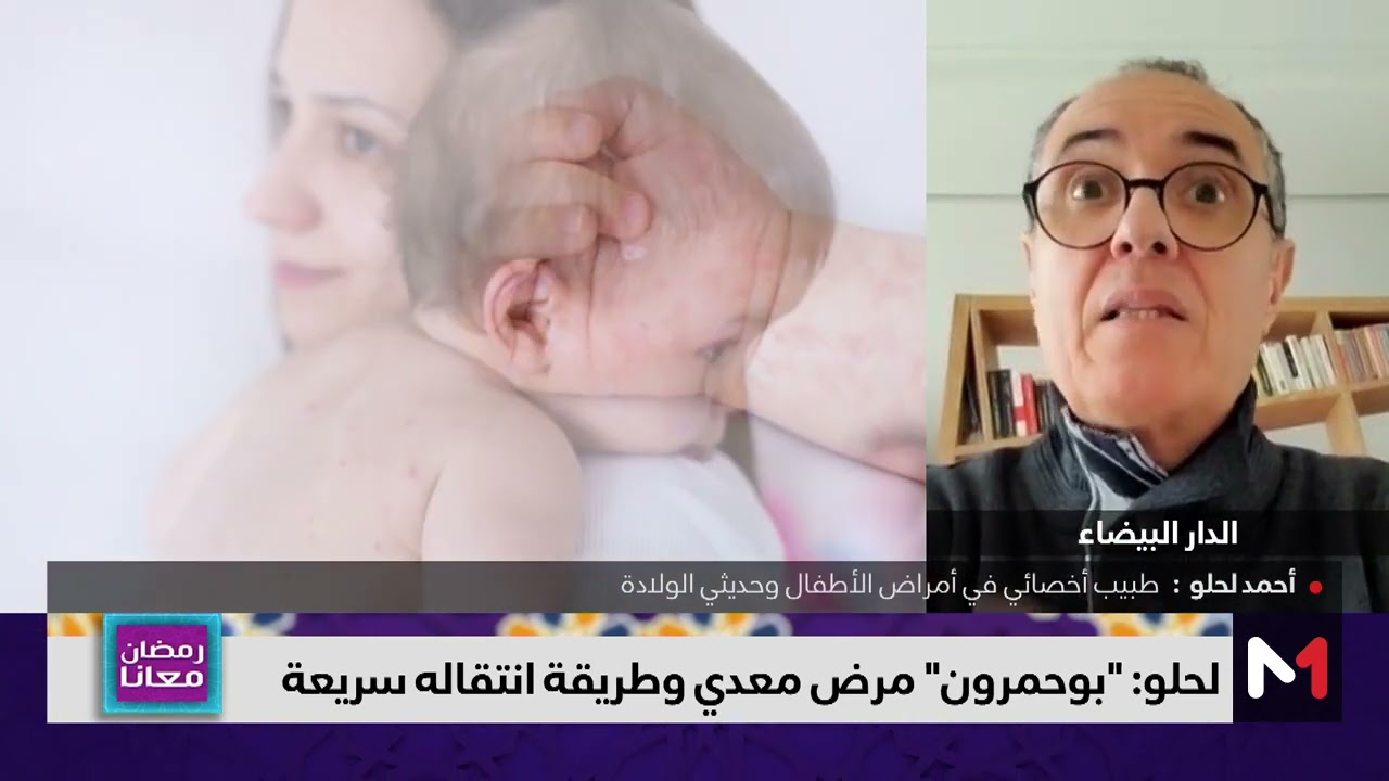 انتشار بوحمرون يثير القلق بالمغرب