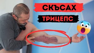 СКЪСАХ ТРИЦЕПС‼️‼️