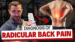 How I Evaluate Radicular Low Back Pain from a Herniated Disc [Physical Therapy Guide]