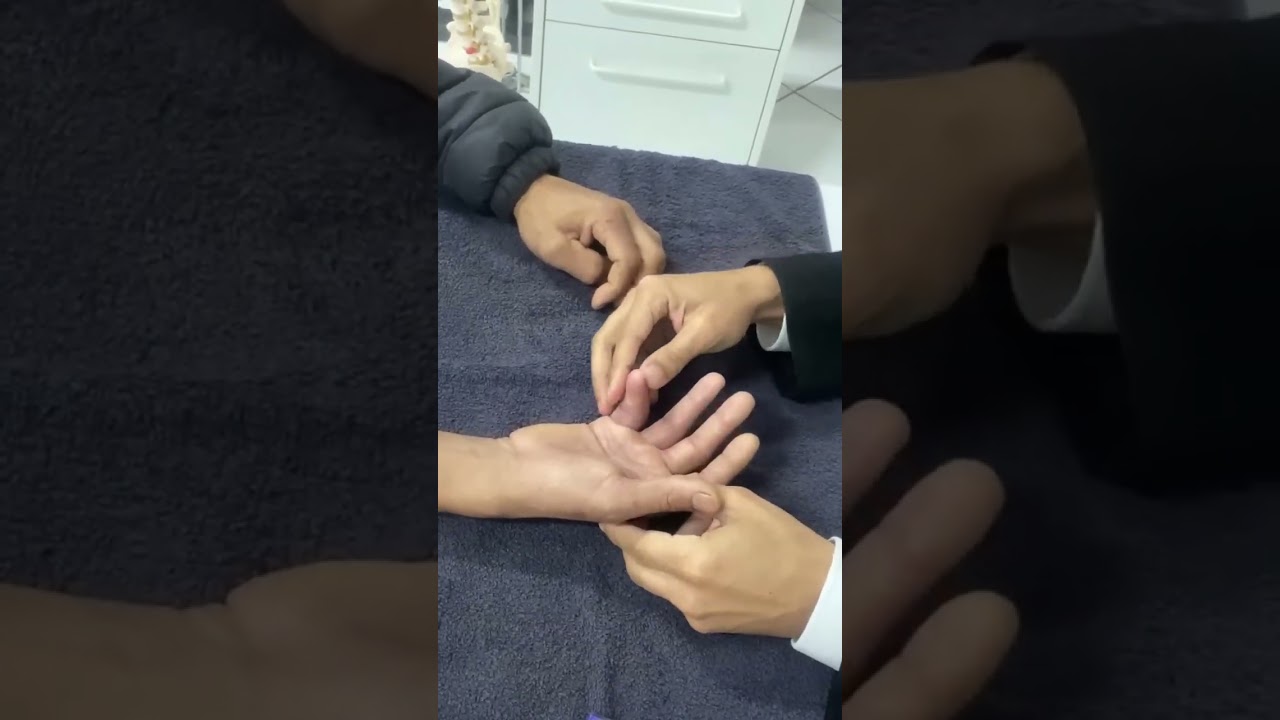 Fratura no Dedo Como Voltar a Mexer a Mão e Recuperar os Movimentos | Fisioterapia Dr. Robson Sitta