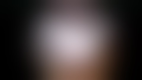 Jordan Bowling - Laparoscopic Resection of Atypical Locations of GISTs