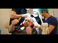 Fue hair transplant procedure step by step  dr bayer clinics hair transplant clinic in turkey 