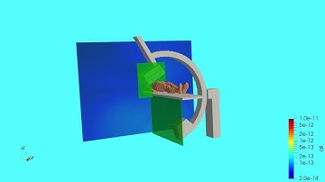 Monte Carlo simulation for Abdominal IVR examination scatter dose distribution