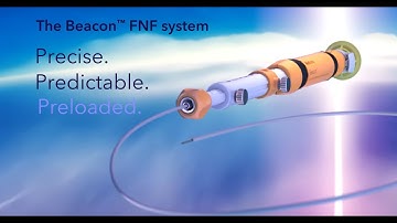 Beacon™ Fiducial System 3D Animation | Step-by-Step Guide, Features & Benefits