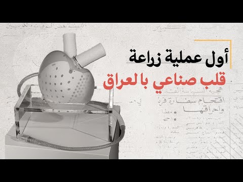 نجاح أول عملية زرع قلب صناعي بالعراق