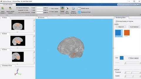 3D Image Segmentation of Brain Tumors Using Deep Learning