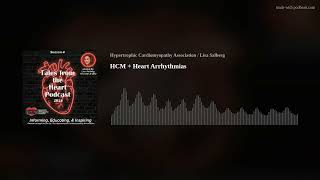 Hcm Heart Arrhythmias