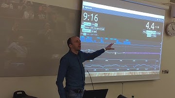 DIY Diabetes Dublin Video 11: My Journey to DIY APS Looping