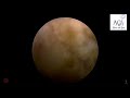Endoscopic postrior cervical discectomy step by step by Dr Ankit Gupta