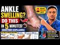 Ankle Swelling? Do This in 5 Minutes! (Doctor Explains)