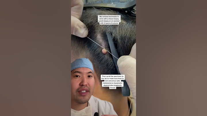 Removing moles at the barber with string? #shorts
