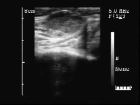 Ecografía Bovina Cuerpo lúteo de 6 días y otro de 12 equinox crate