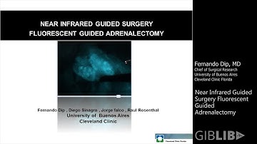 Cancer Imaging: Near Infrared Guided Surgery Fluorescent Guided Adrenalectomy | Preview