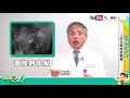 名醫觀點 乳房有鈣化點別慌 8成以上是良性 3狀況需提高警覺 名醫觀點 乳房有鈣化點別慌 8成以上是良性 3狀況需提高警覺
