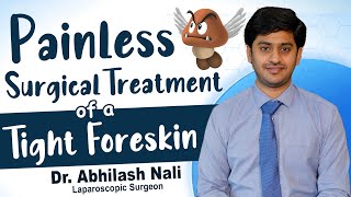 Stapler Circumcision For Phimosis || Best Treatment For Phimosis || Dr Abhilash Nali