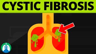 Cystic Fibrosis (Medical Definition) | Quick Explainer Video