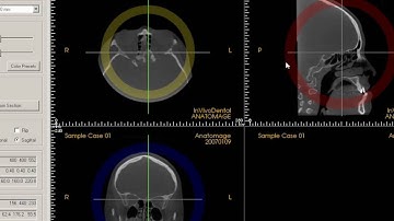 04   Reorienting the patient position  InVivoDental Training Videos
