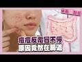 痘痘反覆冒不停？！原因竟然在腸道！3重點找回腸道健康！｜健康儀點靈 @tvbshealth20​