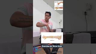 Exercise for Wrist Drop.Treatment for Radial nerve palsy. कलाई के लिए एक्सरसाइज #wristdrop #wrists