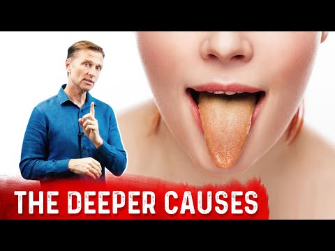 What Causes the Tongue to Change Colors?