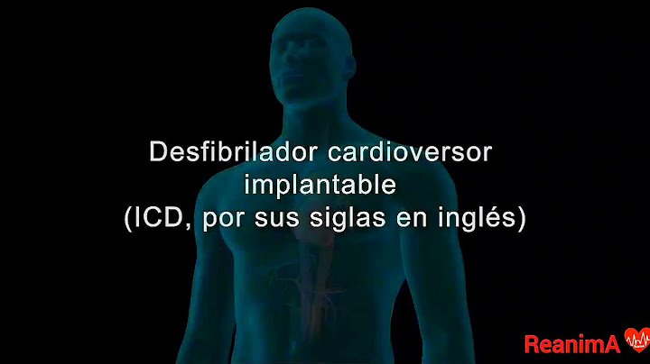 Desfibrilador Cardioversor Implantable...